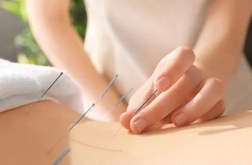 Acupuntura Bilbao EQUILIBRIO para el dolor, insomnio, fertilidad, menopausia y lifting facial con acupuntura