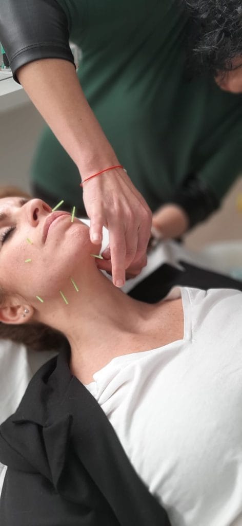 Curso de lifting facial con acupuntura método EQUILIBRIO en Logroño 1ª edición